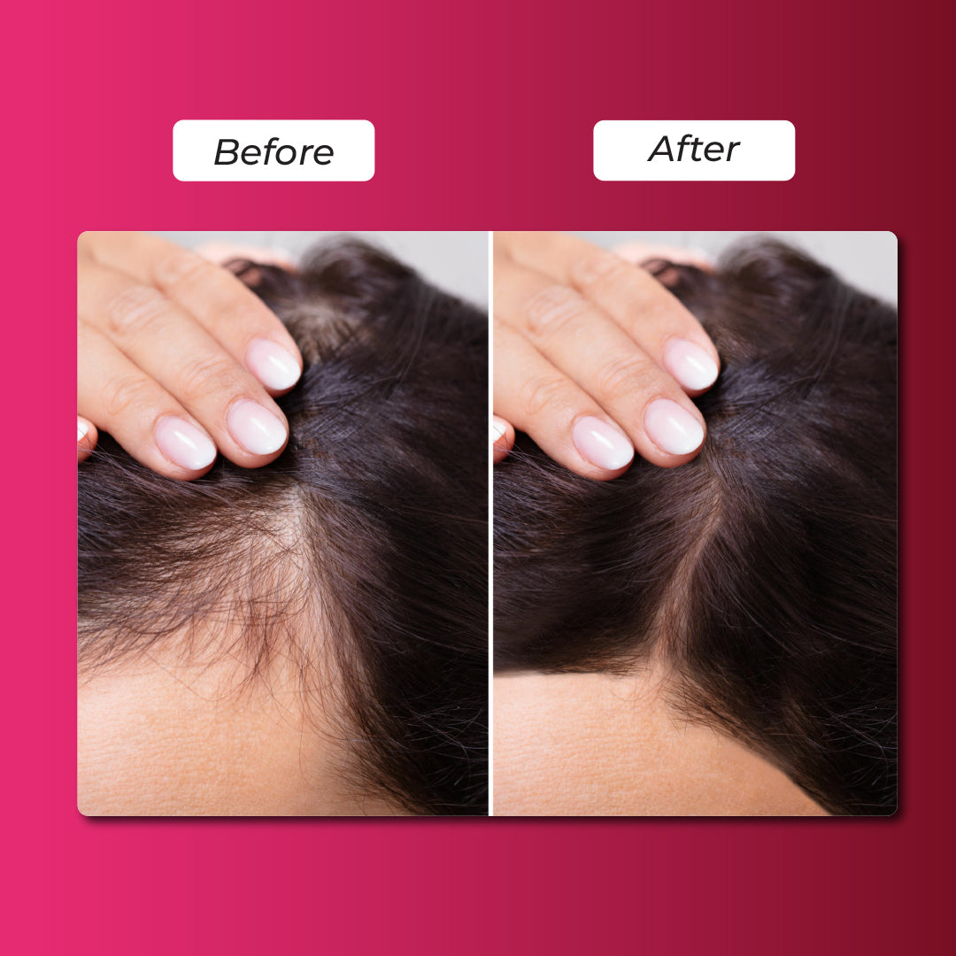 Onion Blackseed Hair Oil