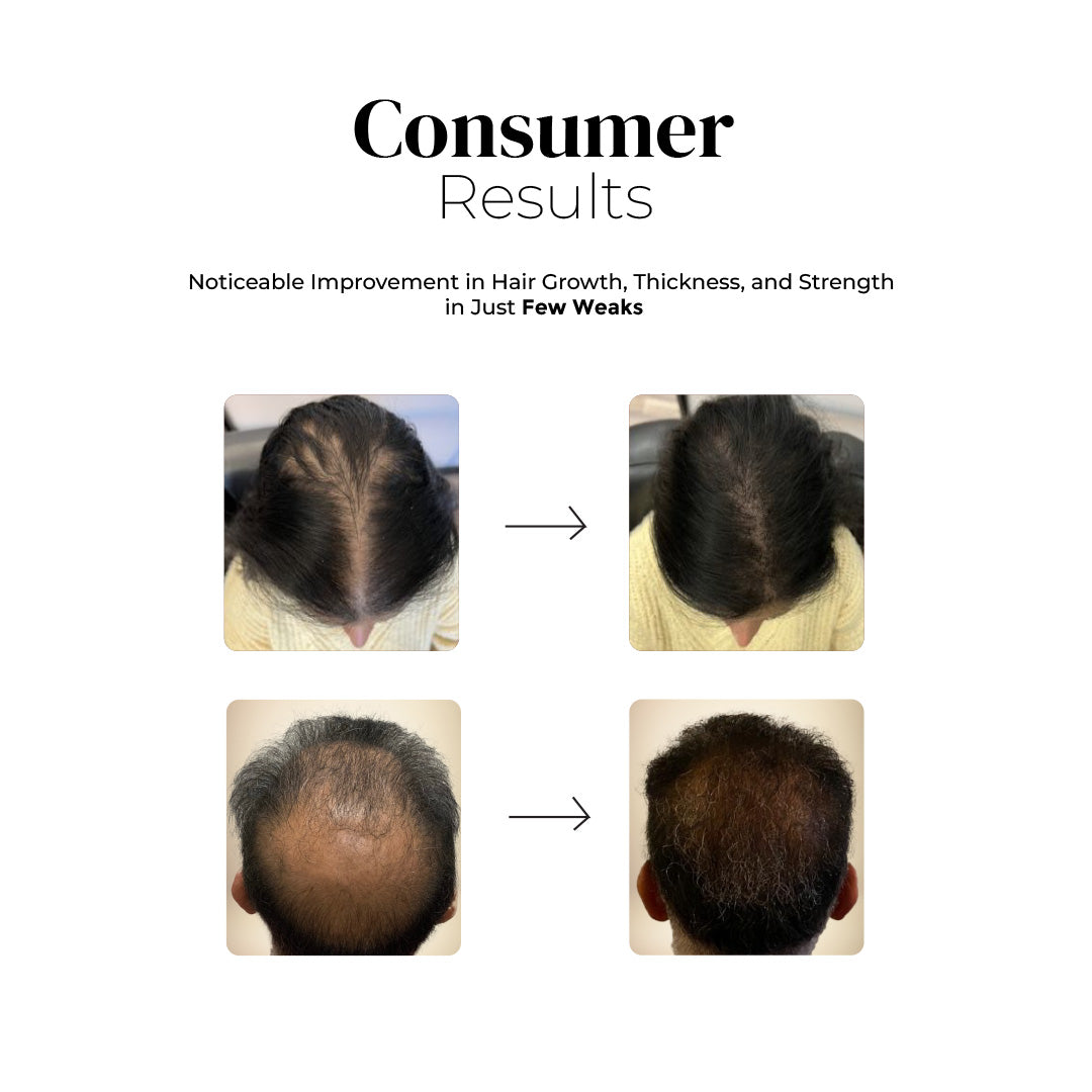 KeshPhal Hair Oil