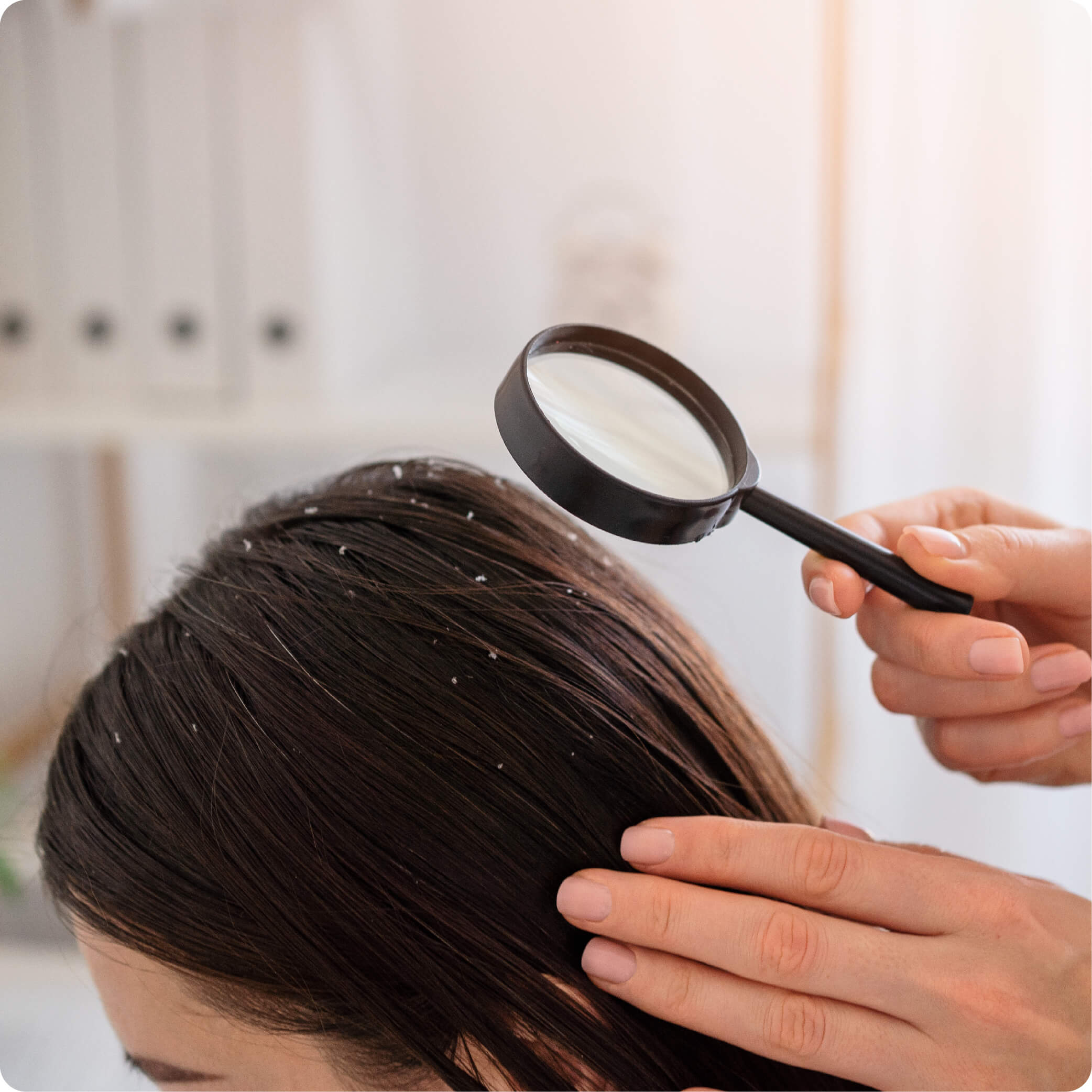 Hair Concerns